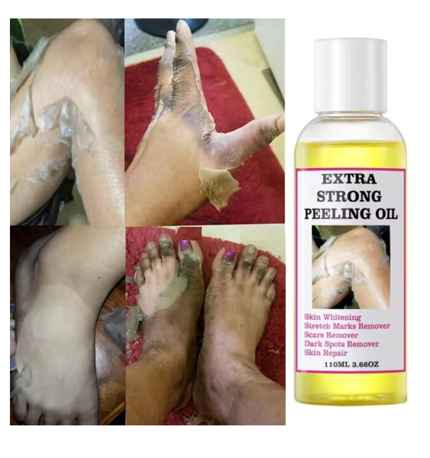 Peeling Oil for Dark Skin, Strong Peeling Oil Extra Strength, Exfoliating Peeling Solution for Body All Skin Type Dead Skin Remover